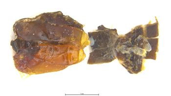 Media type: image;   Entomology 6020 Aspect: body parts